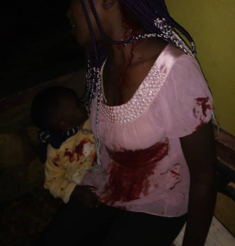 Nord-kivu : Une bombe artisanale piégée fait des victimes en ville de Beni