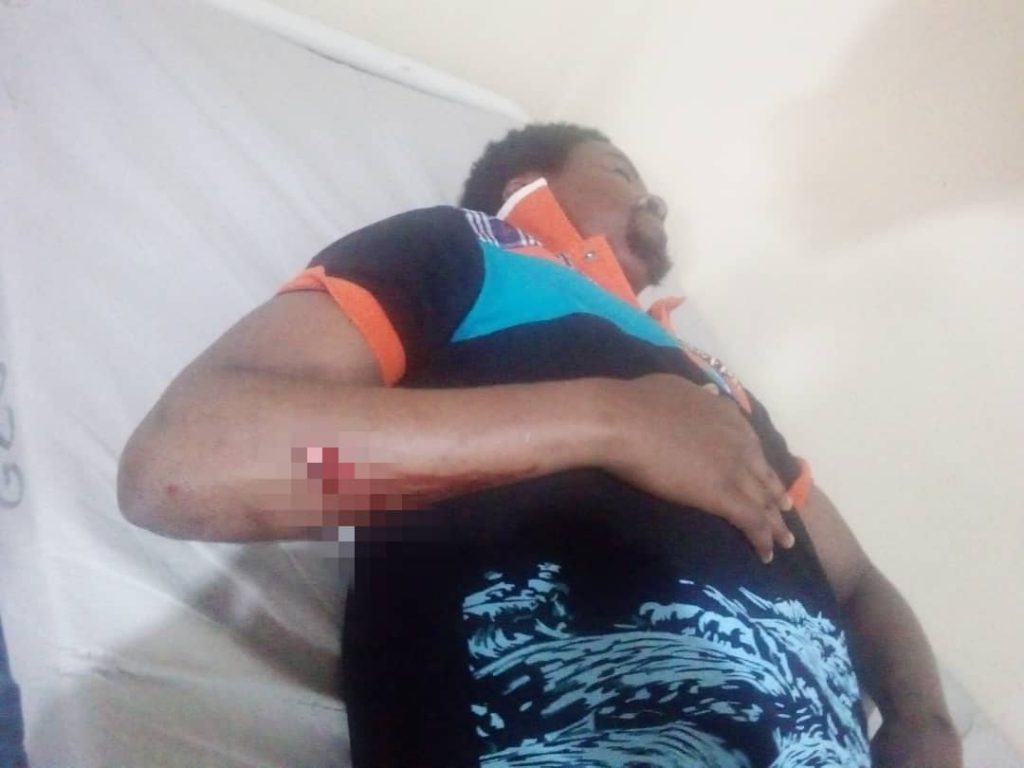Butembo : Chafi Musitu agressé par des présumés partisans du député Tembos Yotama